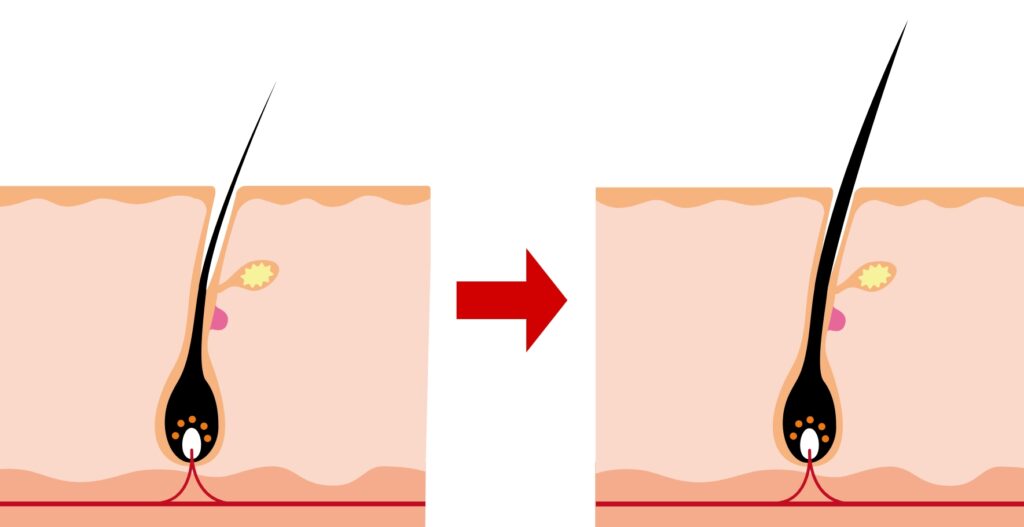 増毛・硬毛化
